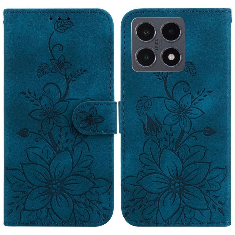 Housse Xiaomi 15T Lys